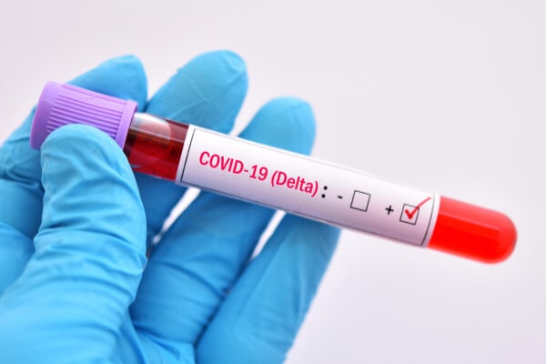 Patient Blood Management During COVID-19 Pandemic