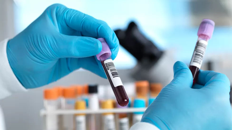 Multi-cancer blood test shows real promise in NHS study